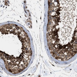 SRPK1 Antibody, Novus Biologicals:Antibodies:Primary Antibodies